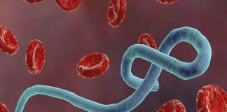 What is Ebola Virus? Ebola Virus